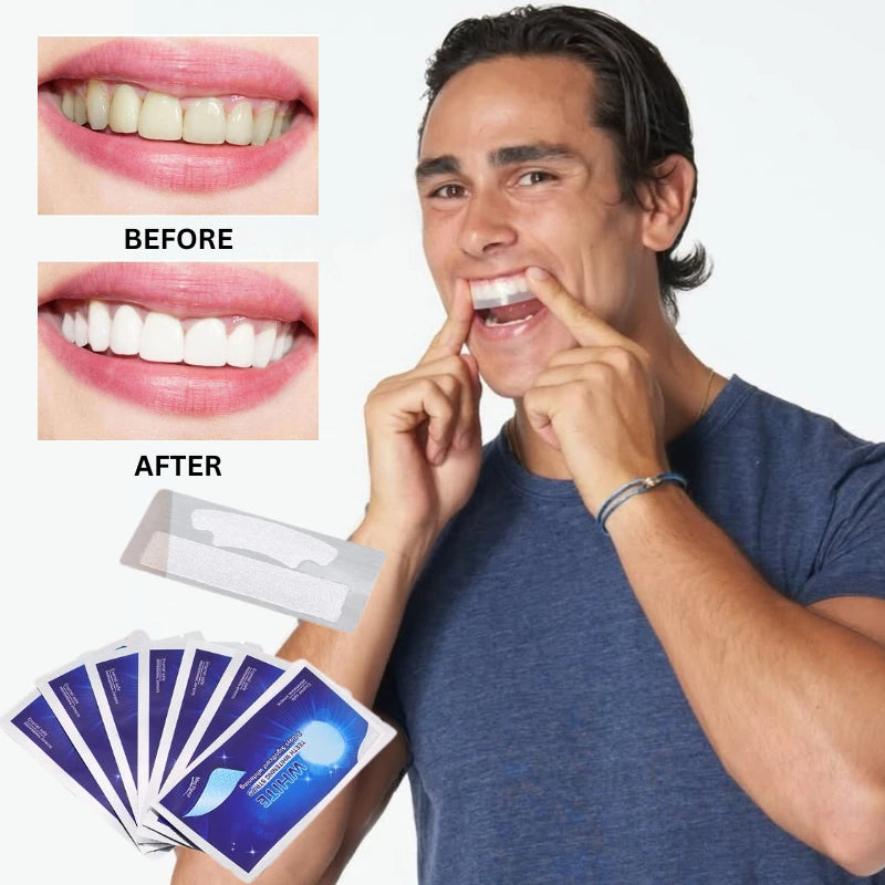 MiChae™ (미채)- Korean Teeth Whitening Strips Kit [28 pcs in 1 pack]