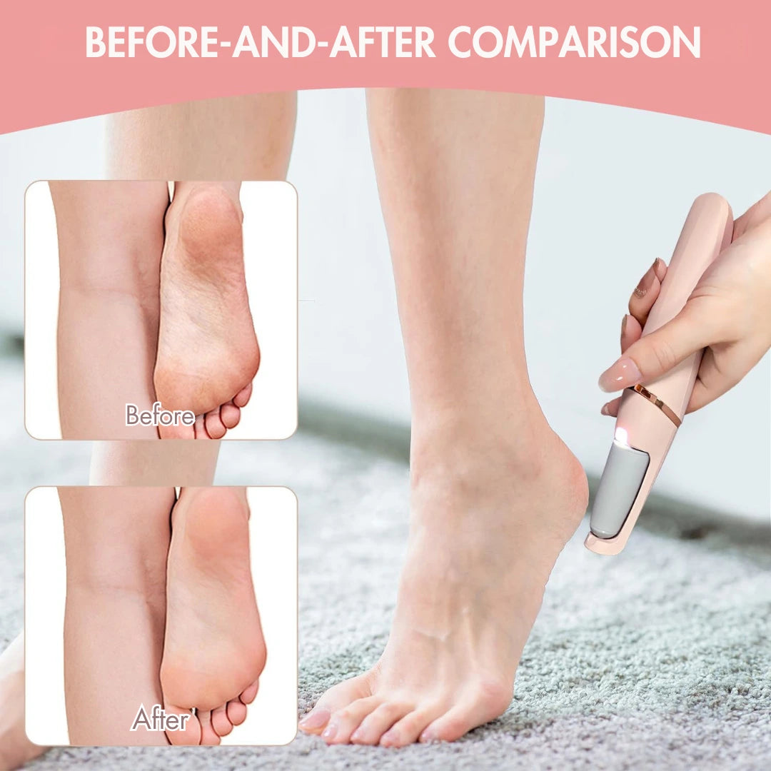 FootEase Pro (1 Year Warranty)