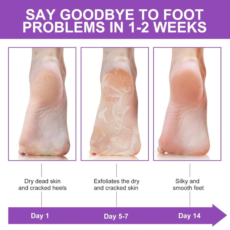 Aramé™ (아라메) Peeling & Exfoliating Feet Mask [IMPORTED SKINCARE]