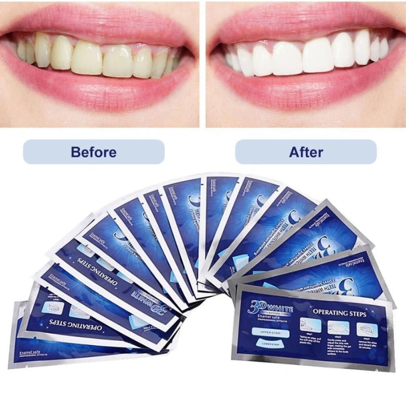 MiChae™ (미채)- Korean Teeth Whitening Strips Kit [28 pcs in 1 pack]