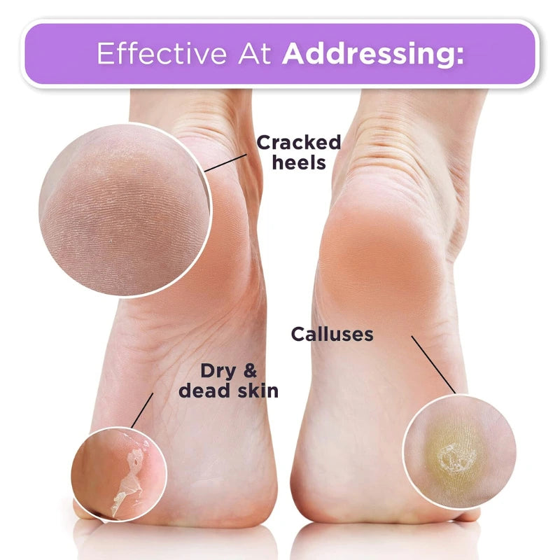 Aramé™ (아라메) Peeling & Exfoliating Feet Mask [IMPORTED SKINCARE]